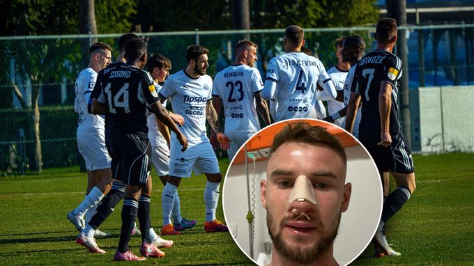 Slovácku zničilo generálku počasí, Vaškovi koukala kost z obličeje. Co posily z Prahy? Slovácku zničilo generálku počasí, Vaškovi koukala kost z obličeje. Co posily z Prahy?