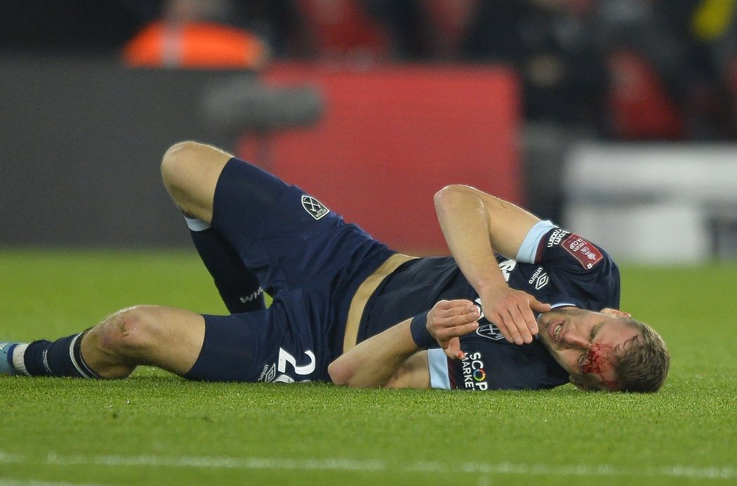 Zraněný český záložník Tomáš Souček při zápase West Hamu proti Southamptonu během Anglického poháru