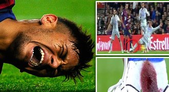 VIDEO: Bourák Neymar. Souboj s Atlétikem dohrál i s dírou v kotníku!