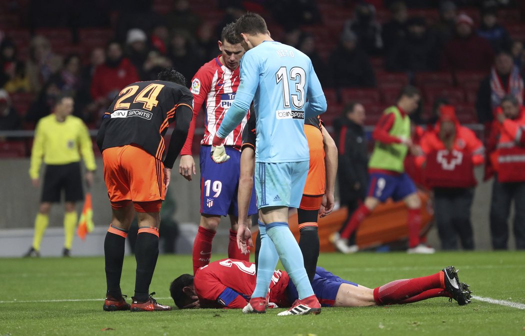 Diego Godín z Atlétika Madrid přišel při ostrém zákroku soupeřova brankáře o zuby