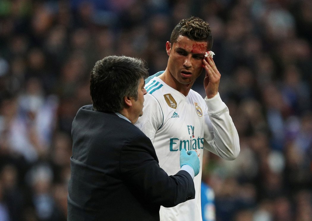 Ronaldo v závěru zápasu utrpěl krvavý šrám