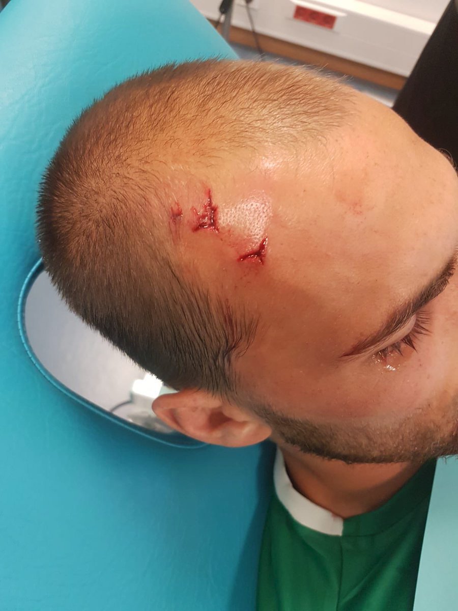 Nizozemský útočník Bas Dost po útoku fanoušků Sportingu v kabinách
