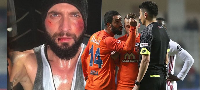 Bouřlivák Arda Turan zbil zpěváka, v nemocnici řádil s pistolí... Teď mu hrozí 12 let ve vězení