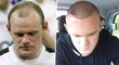 Wayne Rooney po transplantaci vlasů