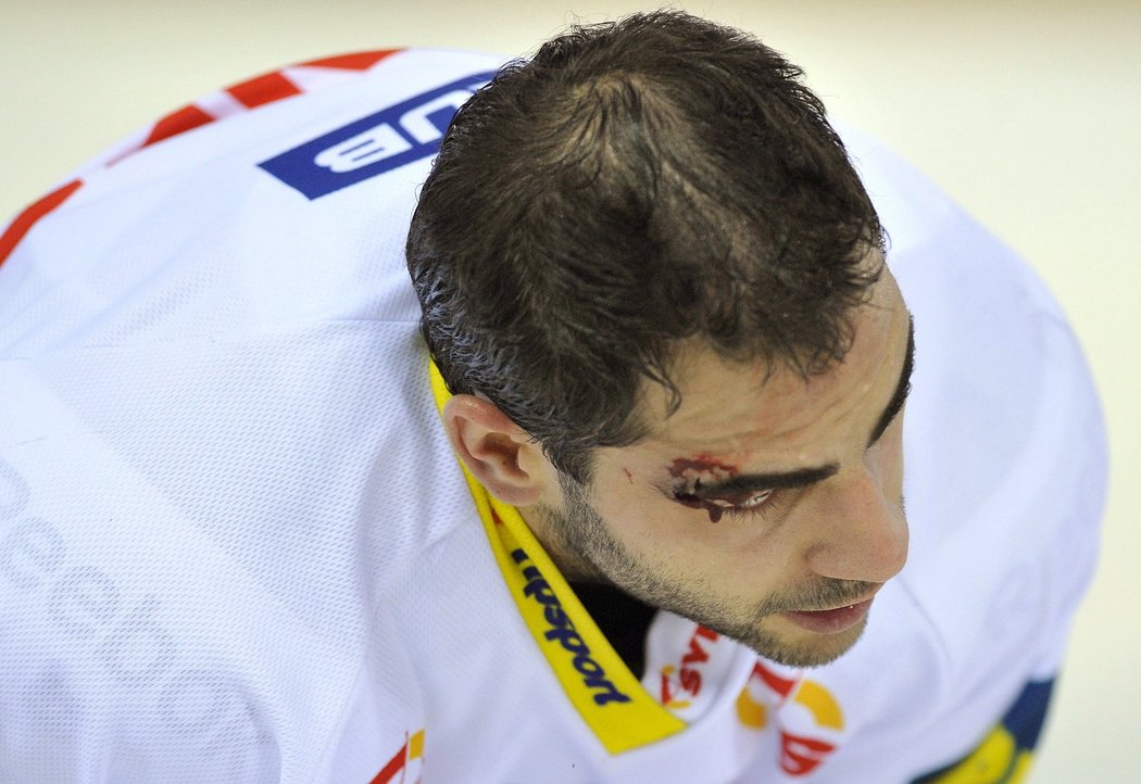 Petr Jelínek si z utkání s Třincem odnesl krvavé zranění