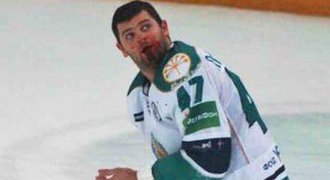 VIDEO: Zkrvavený Radulov. Po zásahu holí přišel o tři zuby