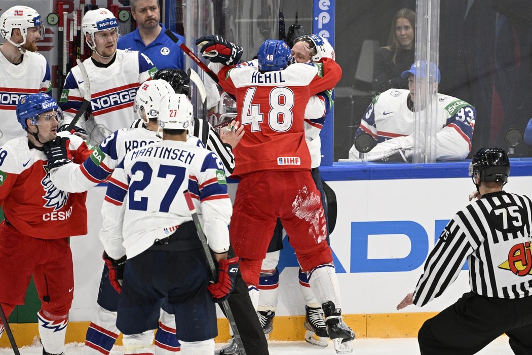 Tomáš Hertl v potyčce během duelu s Norskem