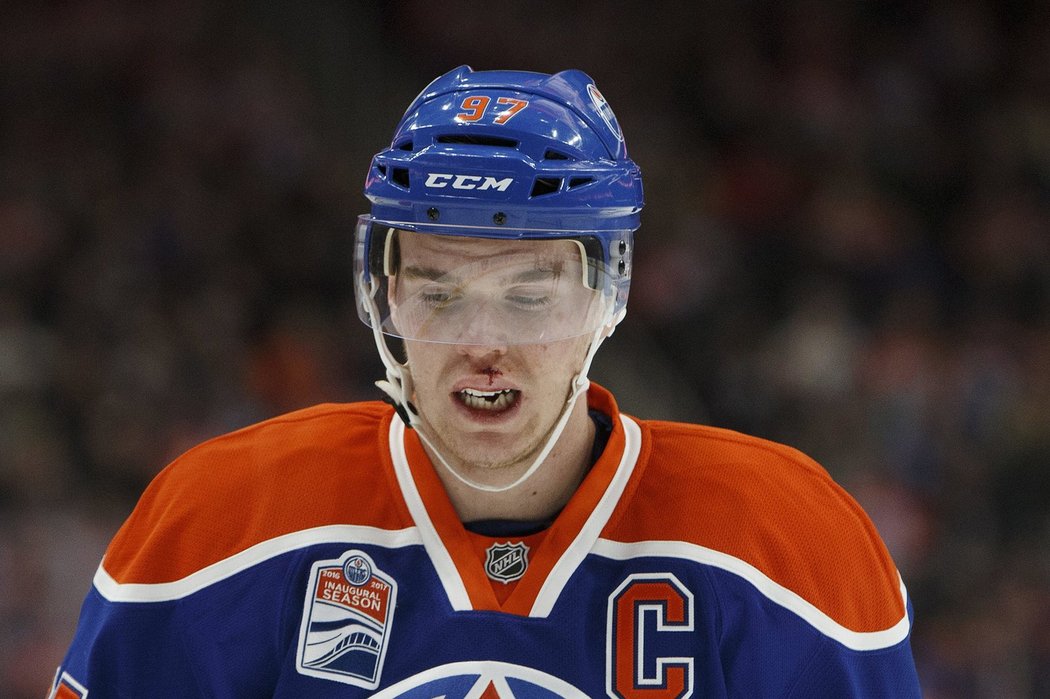 Hvězda Edmontonu Connor McDavid krvácí ze rtu po hře vysokou holí v zápase s Columbusem