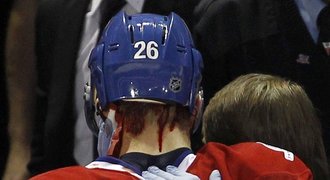Drama v NHL: Bál se, že mu prostřelili hlavu