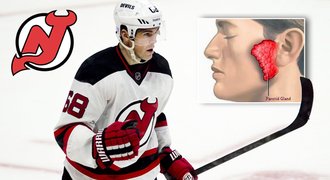 U Jágra řádí příušnice! Devils se potýkají s vysoce nakažlivou virózou