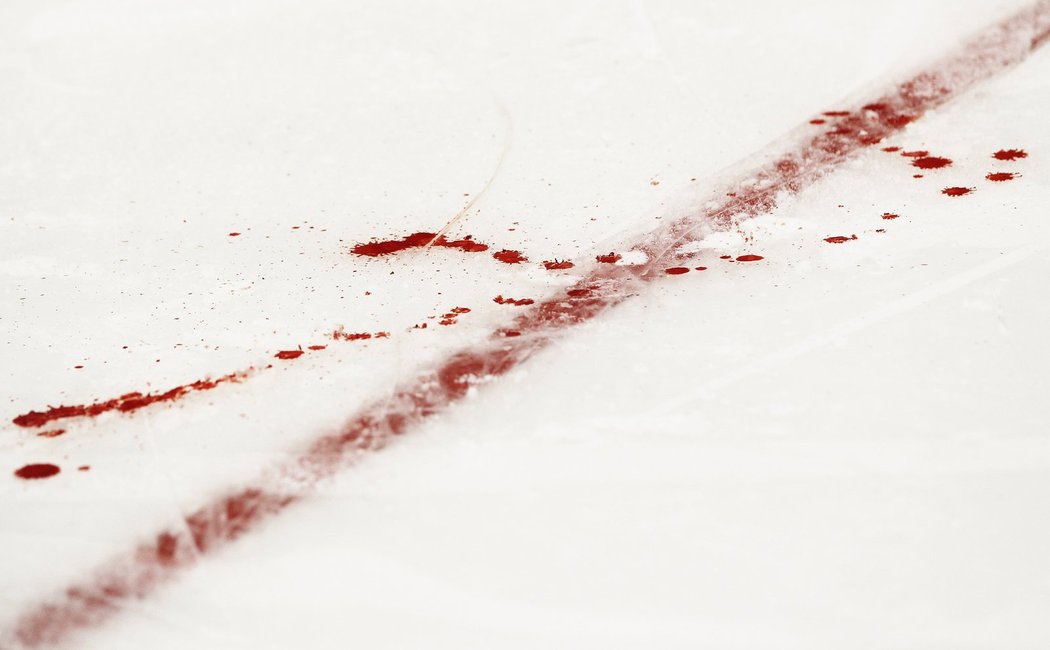Krev Sidney Crosbyho po zásahu pukem do obličeje.