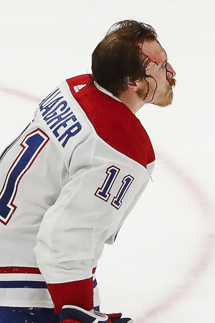 Pohled na zkrvavený obličej útočníka Canadiens Brendana Gallahera