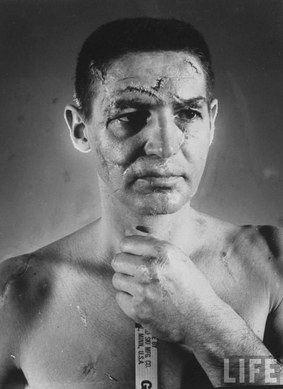 Slavná fotografie Terry Sawchuka. Jeho chytání bez masky si vyžádalo svou daň, utrpěl řadu otřesů mozku a podle hrubých odhadů nasbíral za kariéru okolo 350 stehů v obličeji!