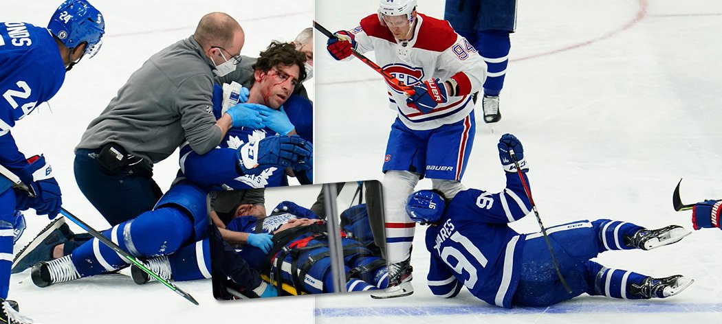 Kapitán Toronta John Tavares skončil v nemocnici poté, co ho trefil kolenem do hlavy montrealský Corey Perry