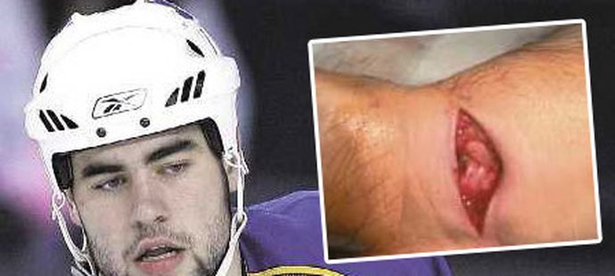 Českému obránci Romanu Polákovi útočník Pittsburghu Sidney Crosby rozřízl ruku