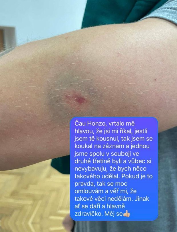 Kousanec na ruce Jana Piskáčka i s omluvnou zprávou Michala Plutnara Kousanec na ruce Jana Piskáčka i s omluvnou zprávou Michala Plutnara