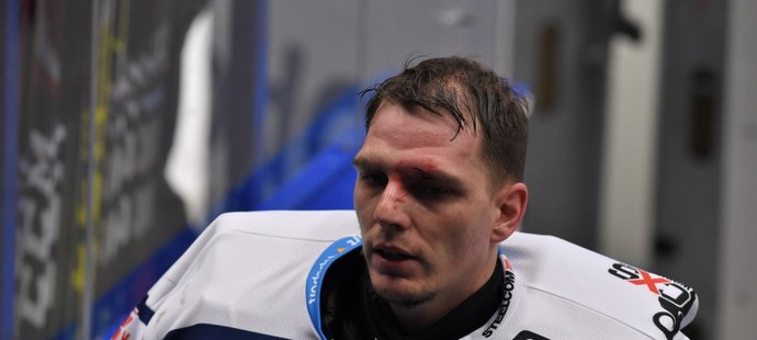 Daniel Dolejš musel v průběhu první třetiny na pár minut odstoupit kvůli krvavému zranění