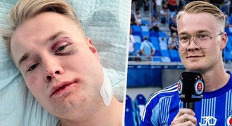 Šok na Slovensku: Brutální napadení hvězdy Slovanu! Šok na Slovensku: Brutální napadení hvězdy Slovanu!