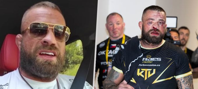 Vémola odkryl svou tvář: První foto po krvavé porážce! Vémola odkryl svou tvář: První foto po krvavé porážce!