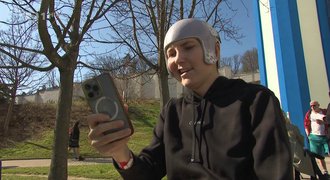 Stav lyžařky Nové se zlepšil, čeká ji další operace. Významný posun, popsal otec Stav lyžařky Nové se zlepšil, čeká ji další operace. Významný posun, popsal otec