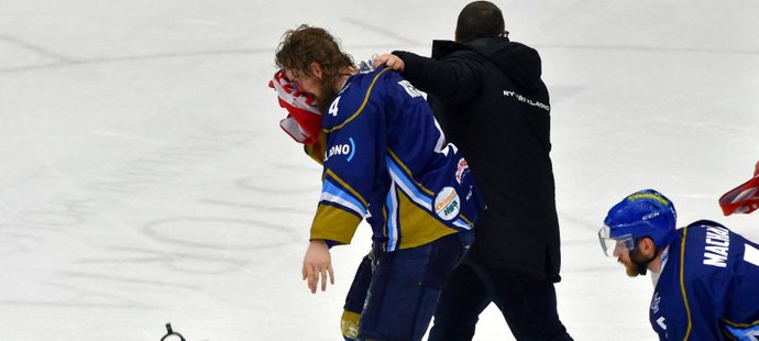Kladenský hráč Martin Kehar si ze souboje s Radkem Dudou odnesl krvácejíci zranění hlavy.