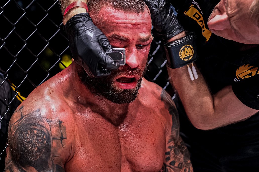 Známý MMA zápasník Karlos »Terminátor« Vémola odkryl svou tvář po duelu s Kinclem, ve kterém utrpěl zranění v obličeji