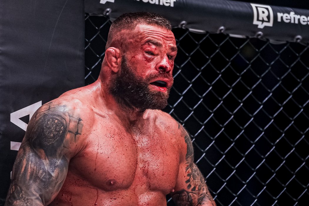 Známý MMA zápasník Karlos »Terminátor« Vémola odkryl svou tvář po duelu s Kinclem, ve kterém utrpěl zranění v obličeji