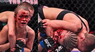 Další šok v kleci! Padla hvězdička MMA v řeži krvavých obličejů