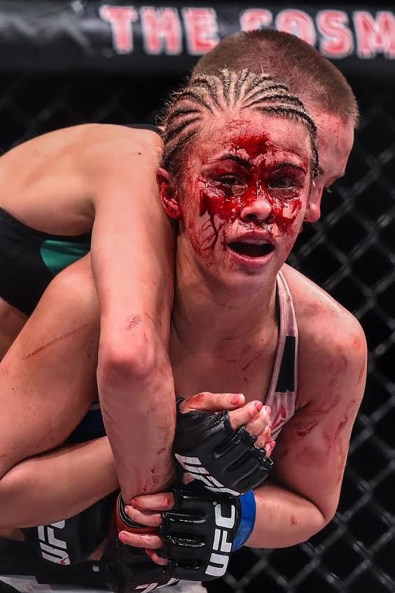 Na konci souboje vypadal obličej Paige VanZantová zničeně