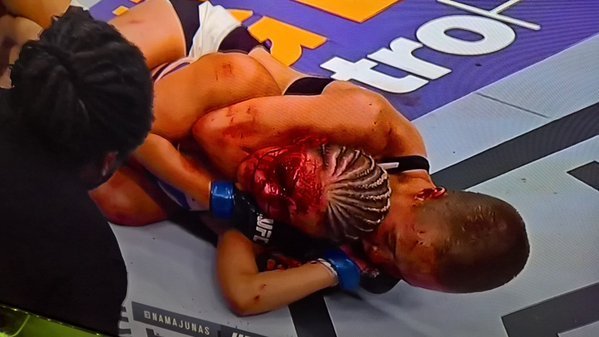 Krev se objevila na obličeji Paige VanZant i vítězné Rose Namajumas