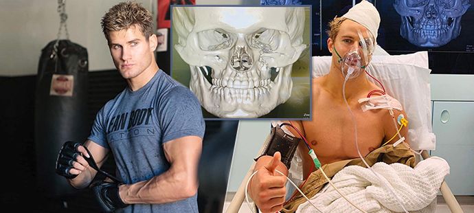 MMA bojovník Sage Northcutt musel po knotkautu podstoupit devítihodinovou operaci.