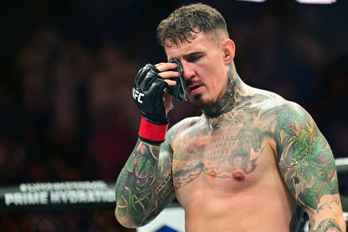 Šampion UFC se vzdává postu kvůli zranění očí. Titul nyní drží muž, který ho skoro oslepil Šampion UFC se vzdává postu kvůli zranění očí. Titul nyní drží muž, který ho skoro oslepil