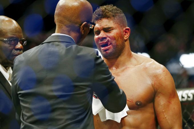 Brutální finiš v UFC, rozervaný ret 4 sekundy před koncem: Nevypadám teď moc sexy Brutální finiš v UFC, rozervaný ret 4 sekundy před koncem: Nevypadám teď moc sexy