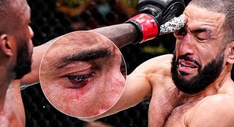 Pozor na prsty! Duel v UFC bez vítěze kvůli dloubnutí do oka, přijdou změny?