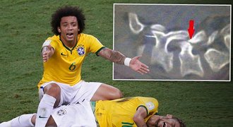 Necítím nohy, hlesl Neymar. Brazílie se bála, aby neochrnul!