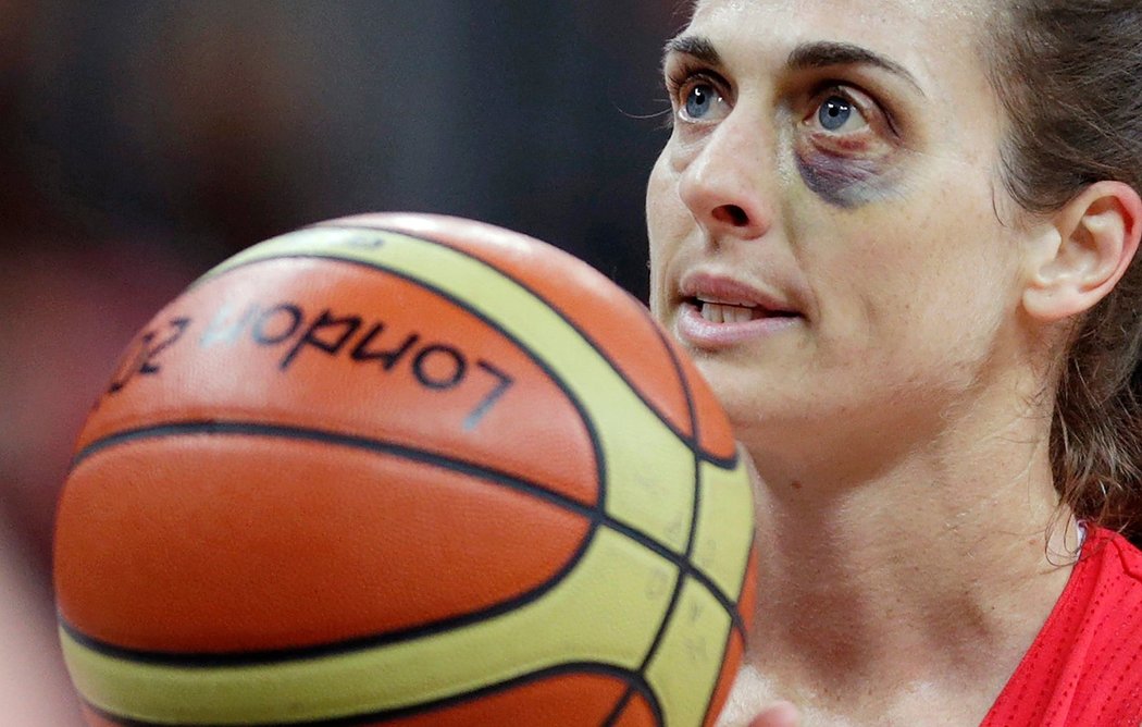 Rány schytá i rozdává. Britská reprezentantka Natalie Staffordová ukázala proti Kanadě basketbalový monokl