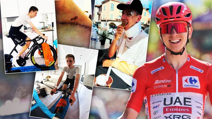 Tři týdny oddych a znovu do tréninku. Pogačar léčí zlomeniny, přesto už šlape na kole Tři týdny oddych a znovu do tréninku. Pogačar léčí zlomeniny, přesto už šlape na kole