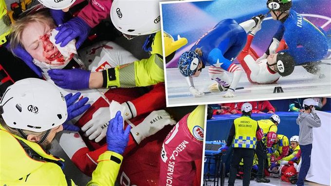 Děsivé zranění na ZOH: brusle Polce rozřízla tvář. Kaluž krve, strach o oko a operace Děsivé zranění na ZOH: brusle Polce rozřízla tvář. Kaluž krve, strach o oko a operace