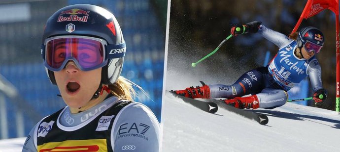 Elitní lyžařka Sofia Goggiaová zveřejnila fotku své nohy po operaci