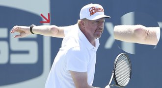 Děsivý tenisový loket Borise Beckera. Má na něm obří bouli!