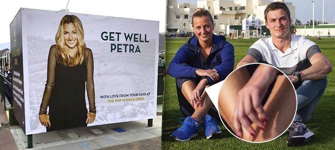 Petra Kvitová na soustředění ukázala ruku bez bandáže, v Indian Wells už se na ni těší