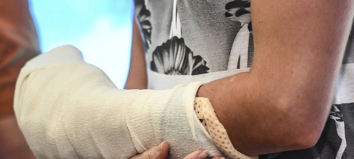 Detail zraněné ruky, kterou museli lékaři tenistce operovat