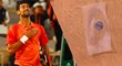 Novak Djokovič vzbudil dohady podivným předmětem přilepeným na hrudi