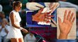 Poraněná ruka Petry Kvitové, kvůli které jí hrozil konec tenisové kariéry. Lupiče, který wimbledonskou šampionku v Prostějově přepadl, policie stále nedostihla