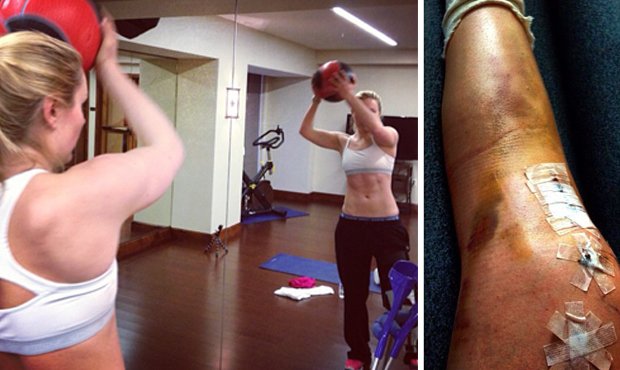 Americká sjezdařka Lindsey Vonnová den po operaci zraněného kolena už trénovala v tělocvičně