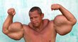 Svých bicepsů docílil Arlindo de Souza injekcemi olejů a alkoholu
