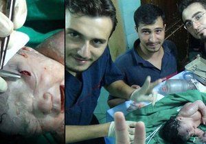 Lékařům v Sýrii se podařilo zachránit těhotnou ženu, kterou zasáhl šrapnel do břicha. Přežilo i její nenarozené dítě.