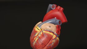 Lidé si srdeční příhodu často pletou s infarktem