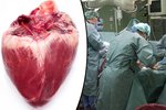 Unikátní operace v Česku: Dočasná srdeční pumpa na tři dny