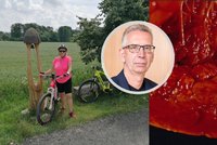 Jiřinu (63) se srdeční arytmií třikrát »nahazovali« defibrilátorem: Zachránil ji speciální zákrok